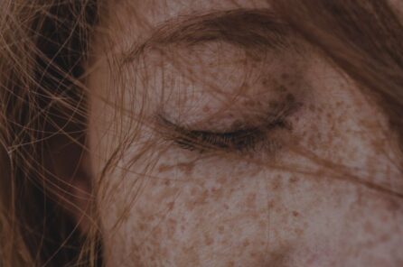 Rostro femenino en primer plano con pecas, ojo derecho cerrado y cabello despeinado que cubre parte del ojo.