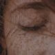 Rostro femenino en primer plano con pecas, ojo derecho cerrado y cabello despeinado que cubre parte del ojo.
