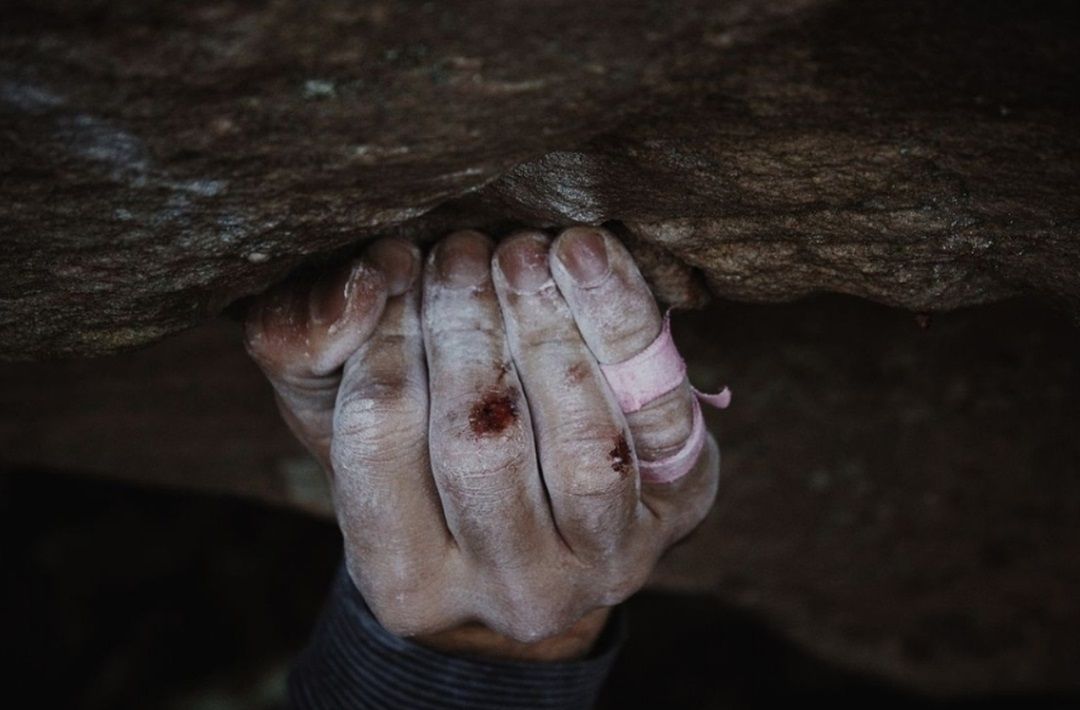 Mano de escalador con heridas en los dedos tras un entrenamiento intenso