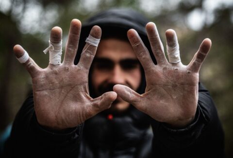 Escalador mostrando las palmas de las manos con magulladuras, símbolo del esfuerzo físico y las lesiones deportivas