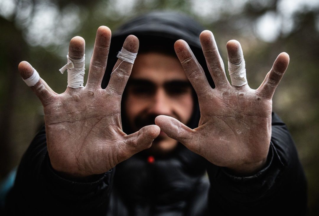 Escalador mostrando las palmas de las manos con magulladuras, símbolo del esfuerzo físico y las lesiones deportivas